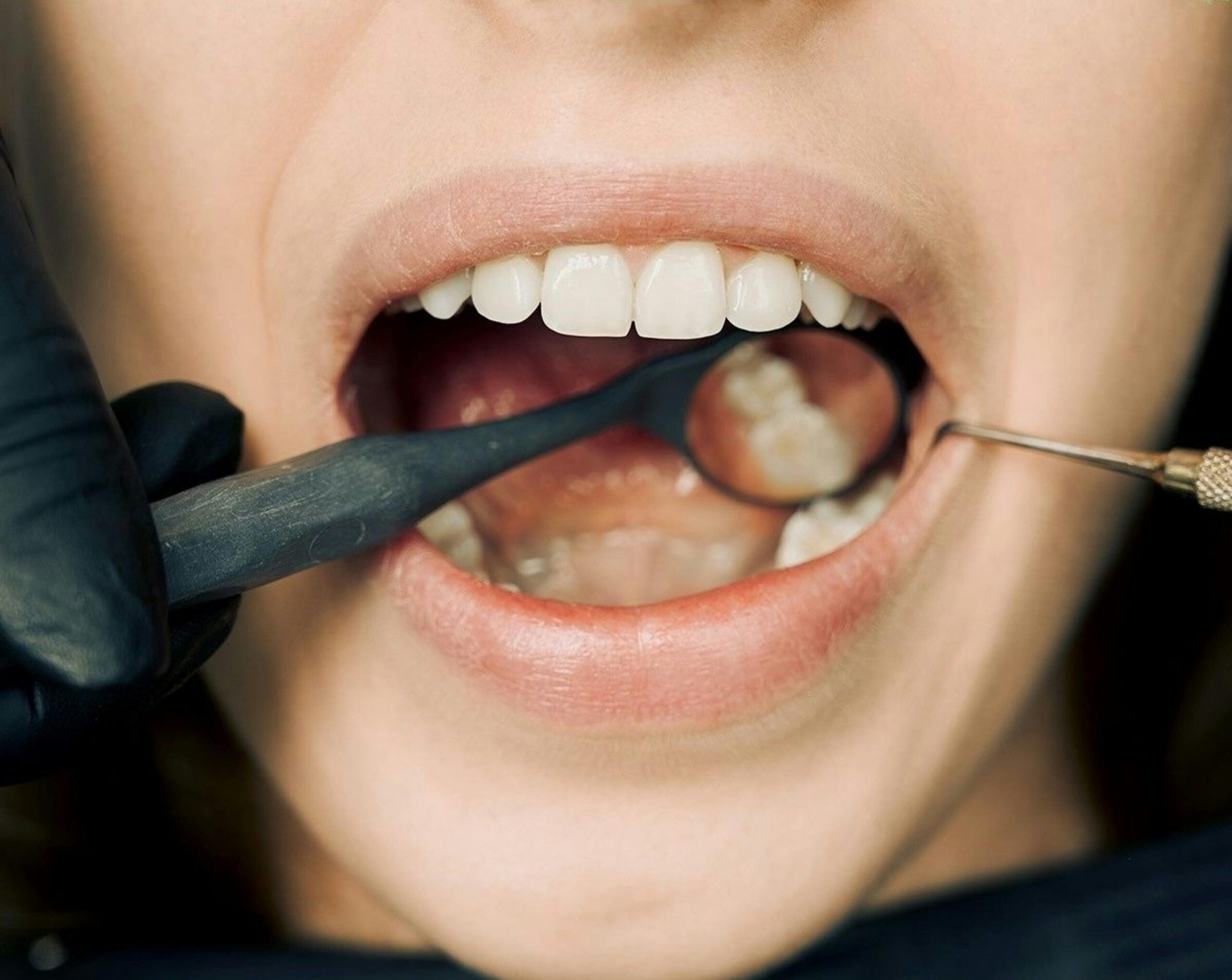 Teeth Cleaning Services in Las Vegas