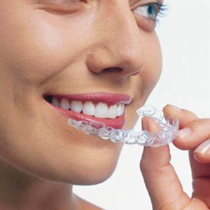 The Advantages and Considerations of Choosing Invisalign in Las Vegas